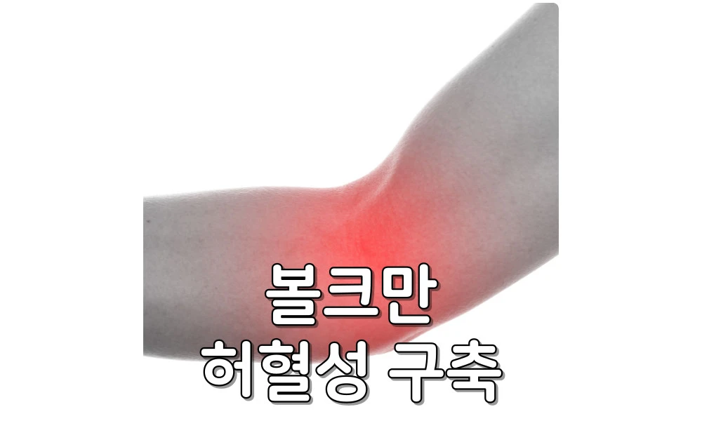 볼크만 허혈성 구축