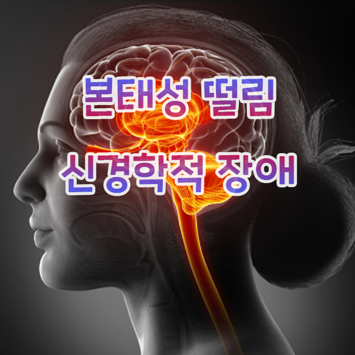 제목과 여성의 뇌의 신경부분의 연결성을 그려놓은 그림 사진입니다.