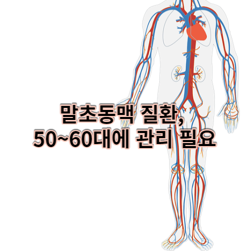  말초동맥 질환, 50~60대에 관리 필요
