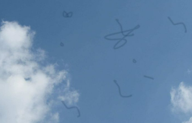 비문증(날파리증)