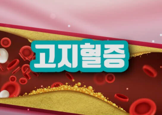 고지혈증, 증상, 원인, 예방 및 치료 그리고 집에서 관리하는 방법