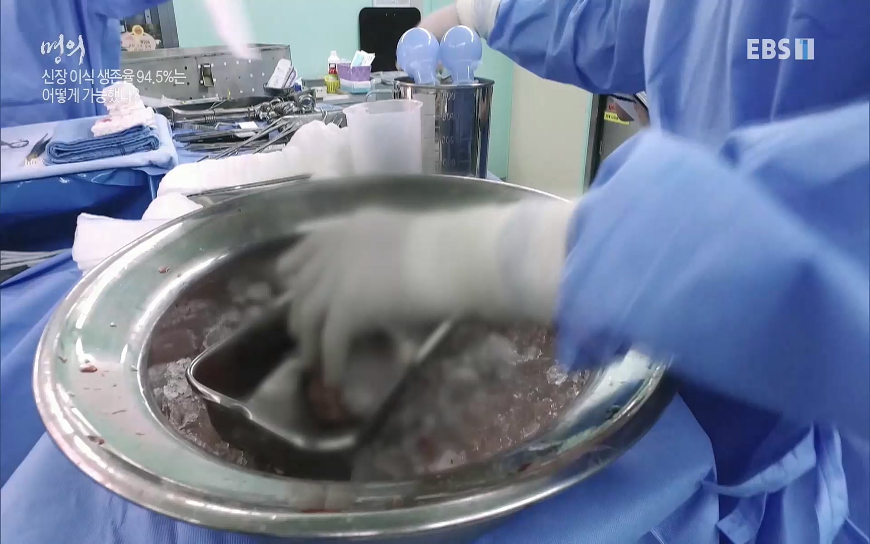 EBS 명의 헬스케어 - TV - 교육의 중심 EBS명의 15년 - 만성 콩팥병 치료, 어디까지 왔나- .mp4_20220802_205730.493.jpg