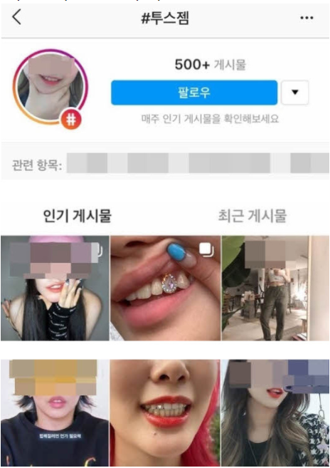  요즘 애들이 패션이라고 이빨에 한다는 행동 충격적이네