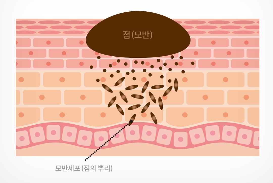 점의 뿌리