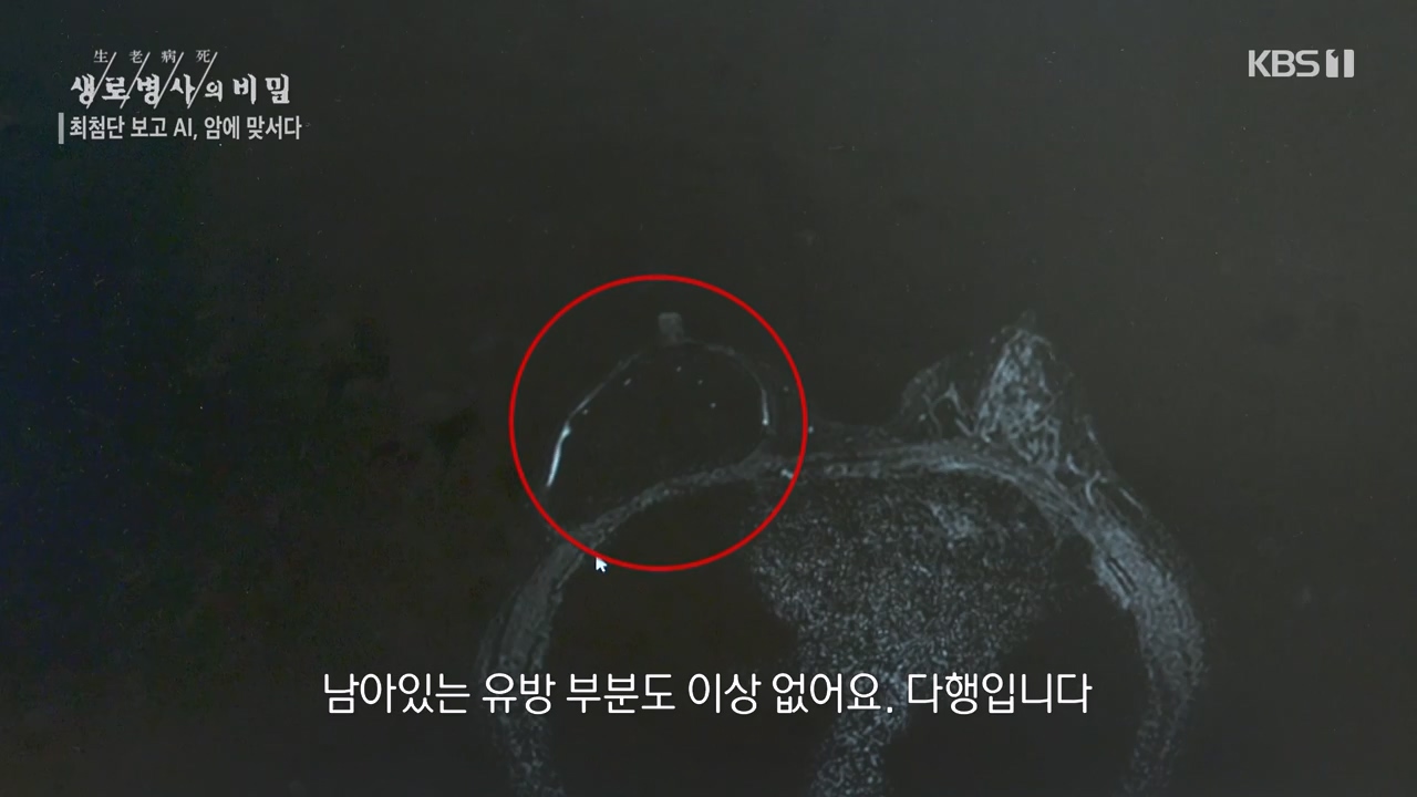 생로병사의 비밀.E881.230831p-NEXT.mp4_20230901_223256.353.jpg