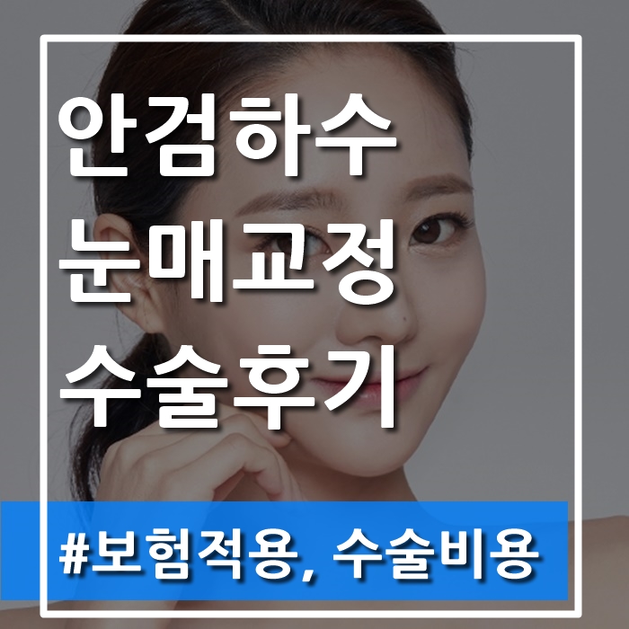 안검하수 보험적용, 수술비용 : 수술후기 안검하수 보험적용, 수술비용 : 수술후기