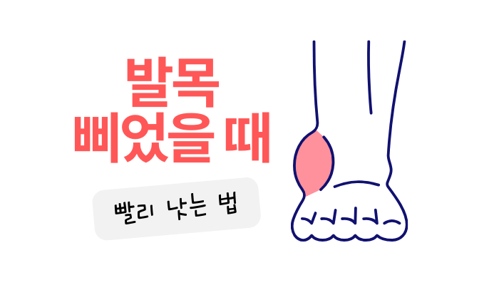 발목 삐었을 때 빨리 낫는법