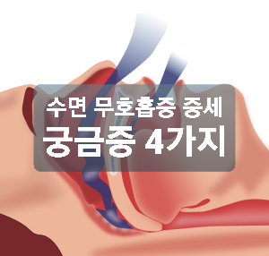 수면 무호흡증 증세에 대한 궁금증 4가지