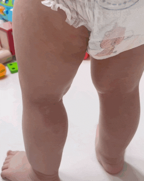 아기 코로나바이러스 증상은 발열, 검사도 모르고 지나칠 뻔 6