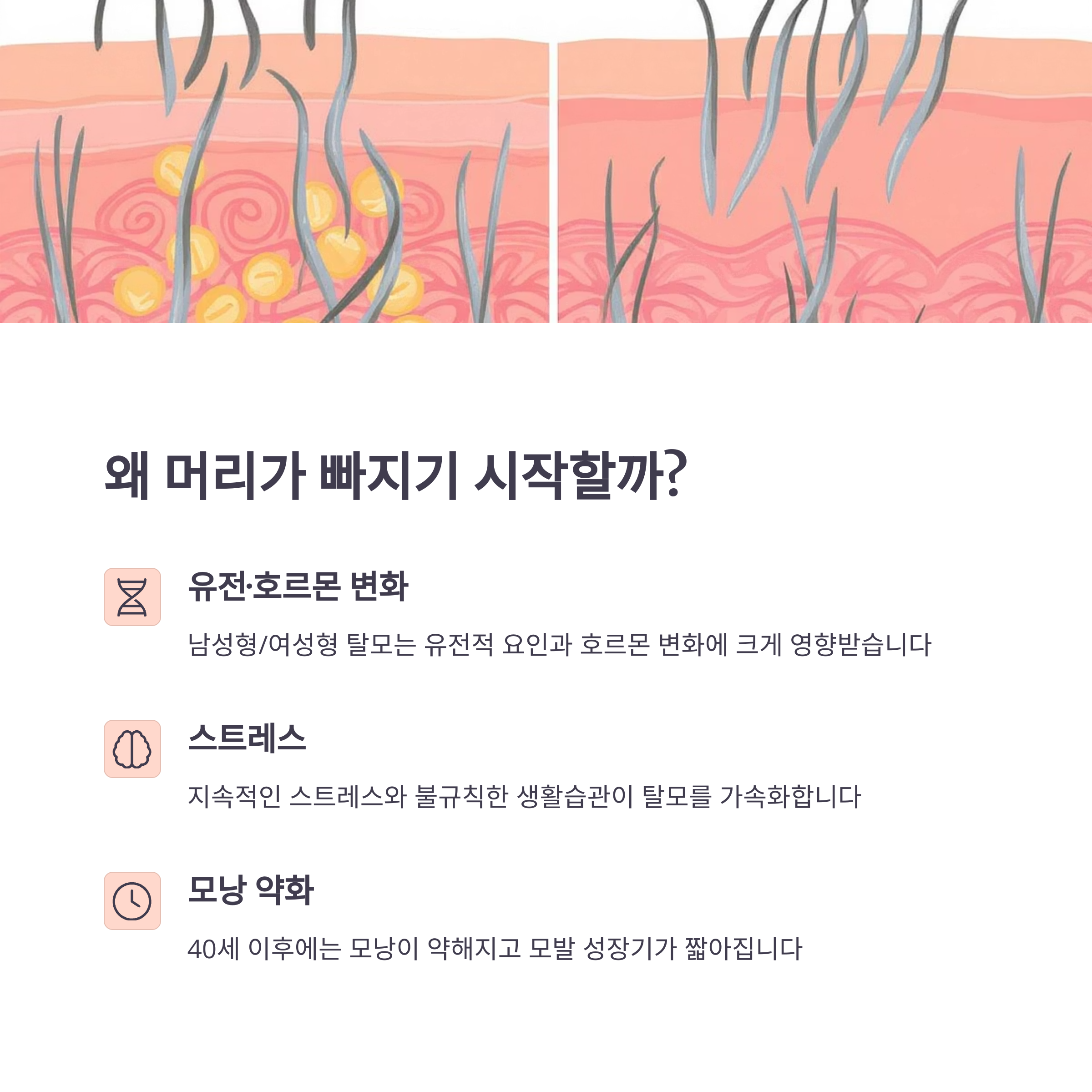 중년 탈모, 샴푸보다 중요한 생활습관