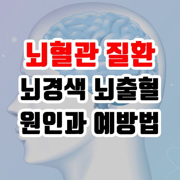 뇌혈관 질환 뇌경색 뇌출혈 원인과 예방법