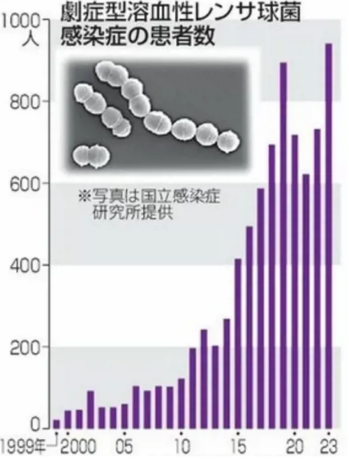 치사율 30% 감염병