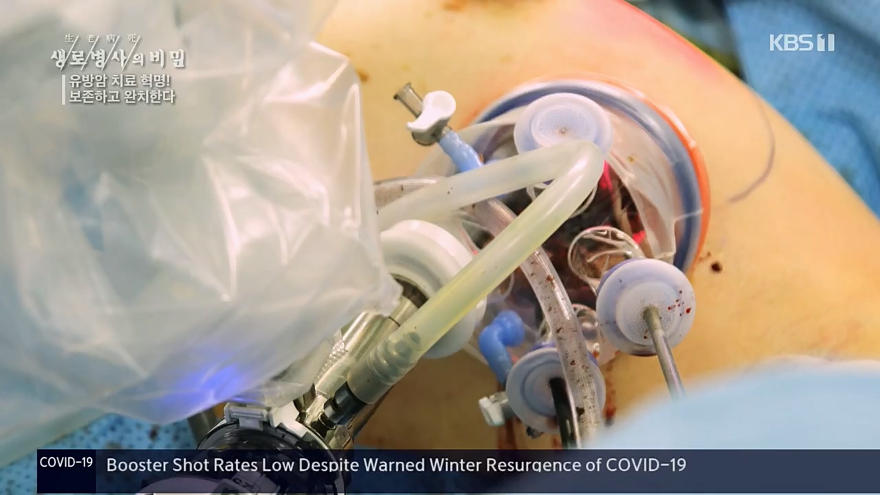 생로병사의 비밀.E845.221131p.H264-F1RST.mp4_20221201_215307.070.jpg