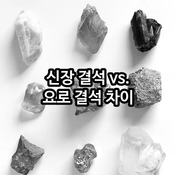 신장 결석 vs 요로 결석 차이