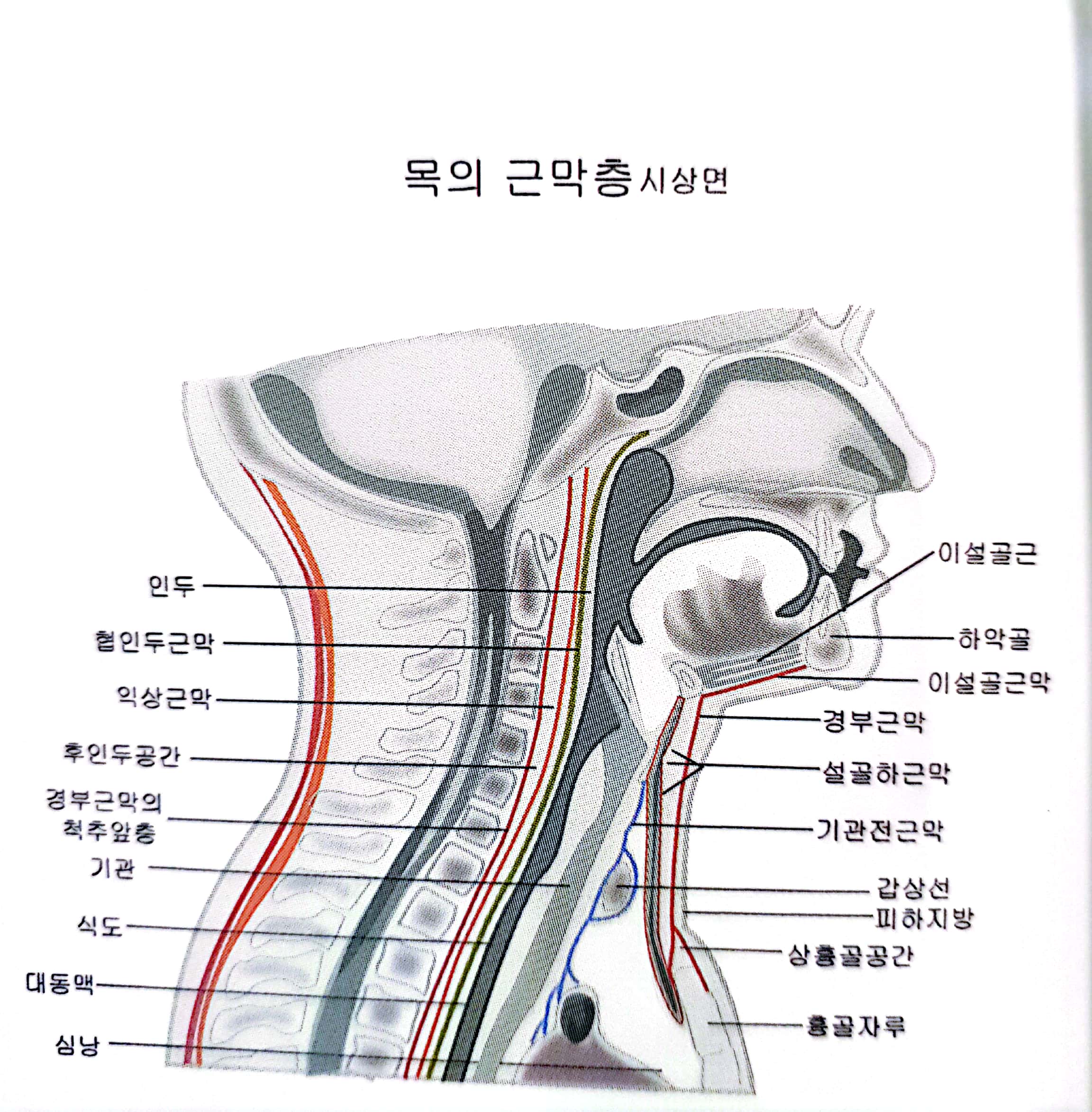  만성 기관지염 증상 및 치료 폐질환
