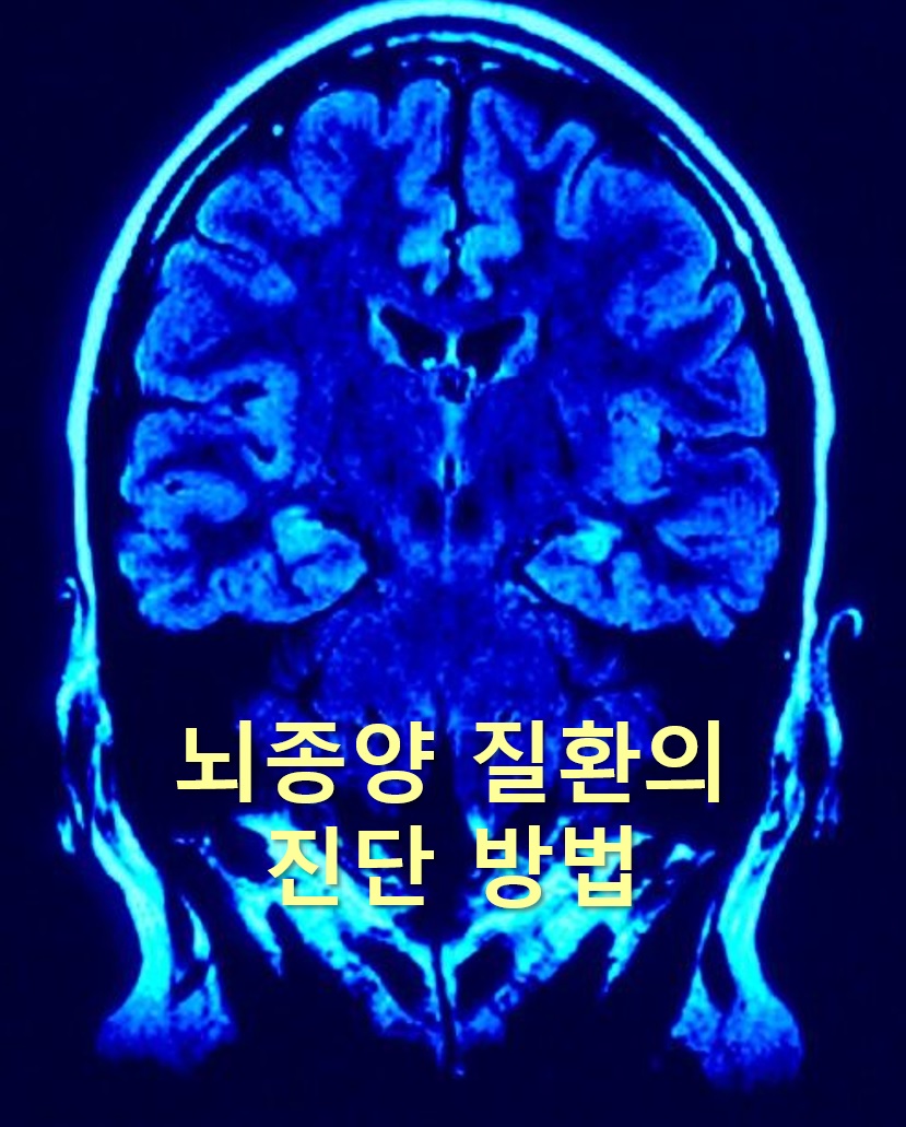  뇌종양 진단을 위한 뇌CT 검사와 뇌MRI 검사 방법