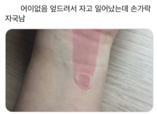  엎드려서 자고 일어났는데ㅋㅋㅋㅋㅋㅋㅋㅋ
