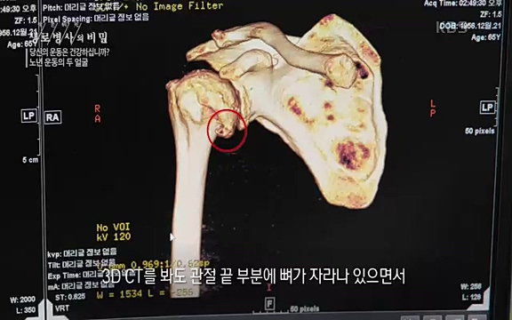[821회] 생로병사의 비밀 - KBS821회] 생로병사의 비밀.ts_20220824_145726.363.jpg