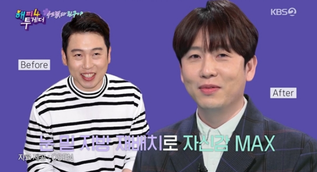  눈밑지방재배치 수술비용