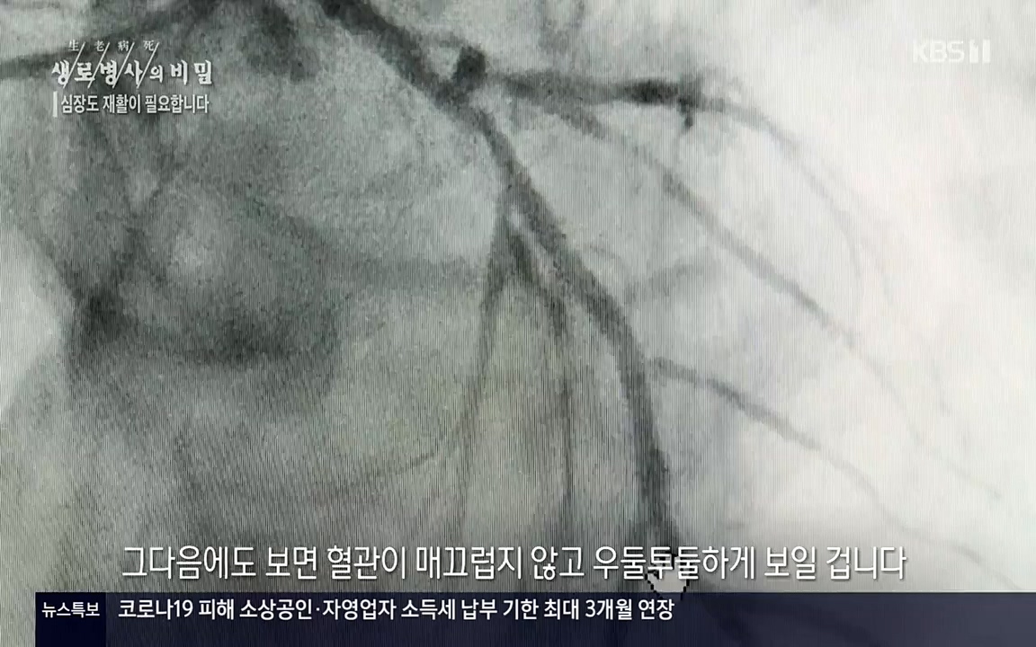 생로병사의 비밀.E820.220428p-NEXT.mp4_20220501_192735.010.jpg
