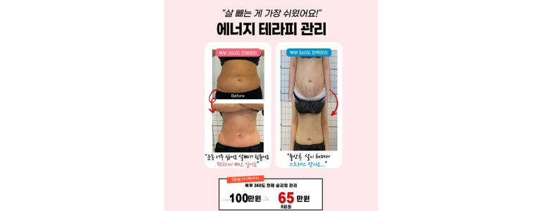 서산시 피부관리