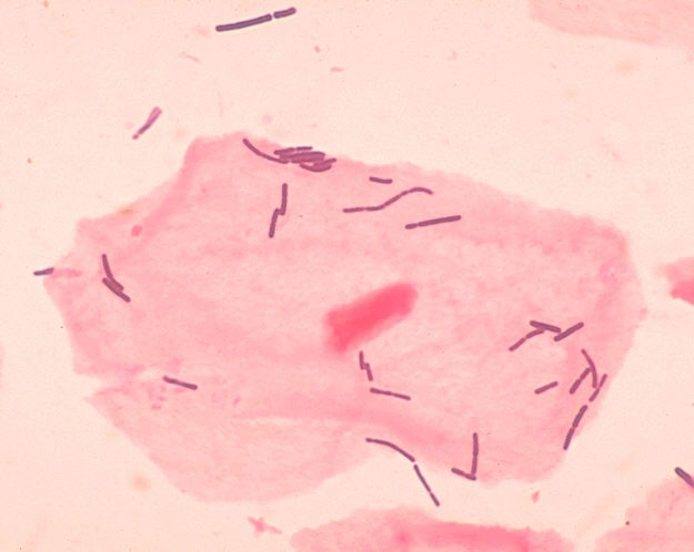 락토바실러스 유산균
