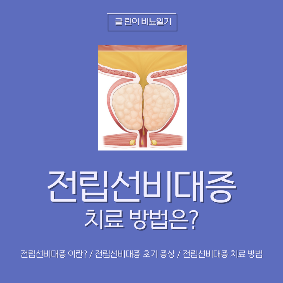  전립선비대증 치료 방법은?