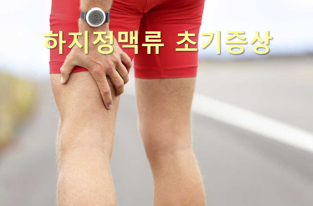  하지정맥류 치료방법과 하지정맥류 초기증상