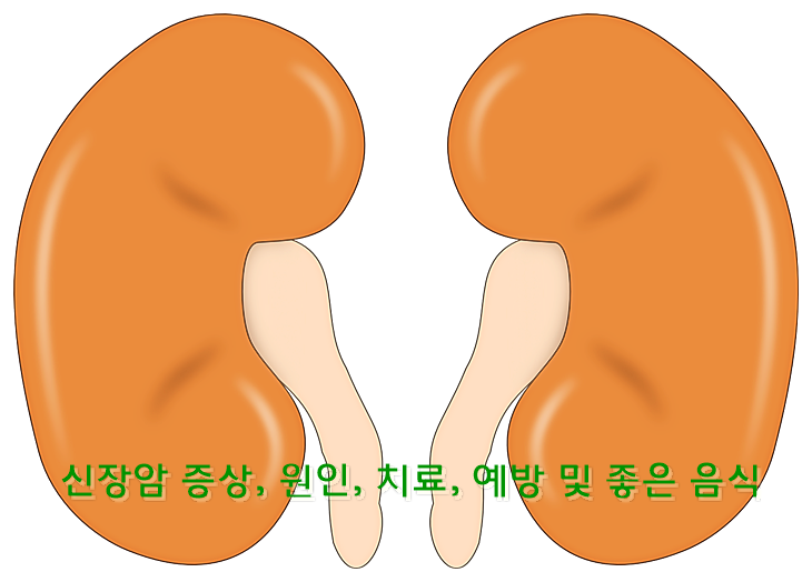 신장암 증상&#44; 원인&#44; 치료&#44; 예방 및 좋은 음식