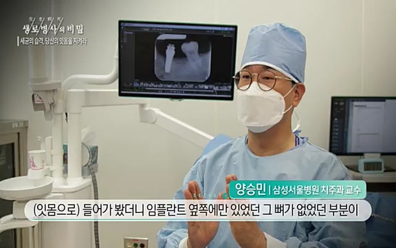 [792회] 생로병사의 비밀 - KBS[세균의 습격, 당신의 잇몸을 지켜라!] 감기보다 병원을 더 자주 찾게 만드는 질병이 있다. 바로 치주질환이다. 2020년 외래 다빈도 질병 1위를 차지한 치은염 및 치주질환 환자는 1,637_20220505_141118.351.jpg