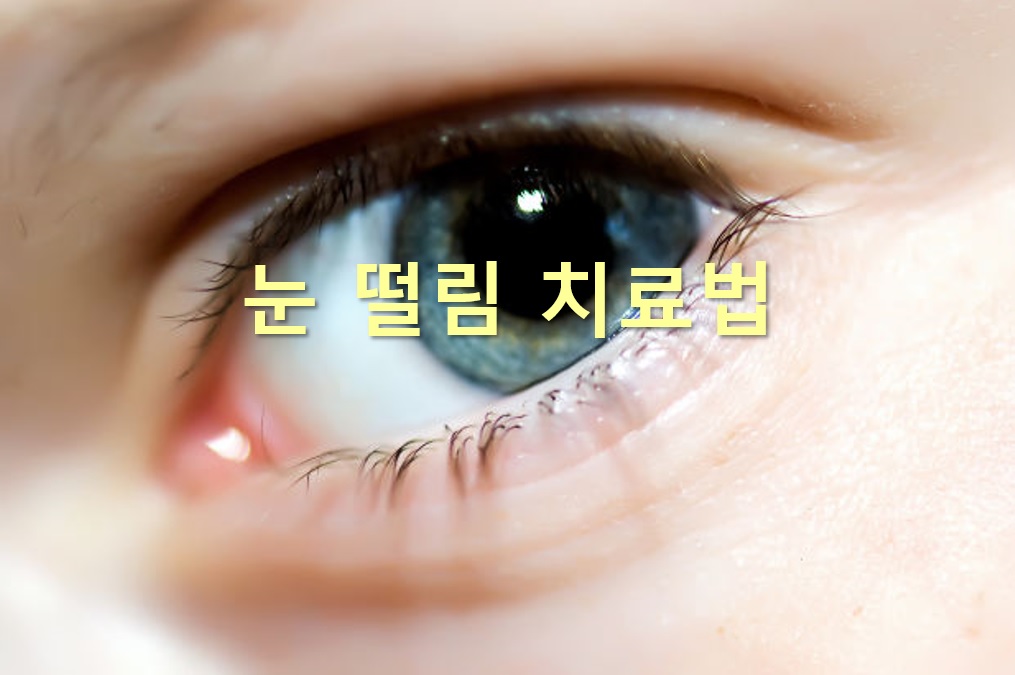  눈 떨림 치료법과 눈 떨림 마그네슘 부족 증상