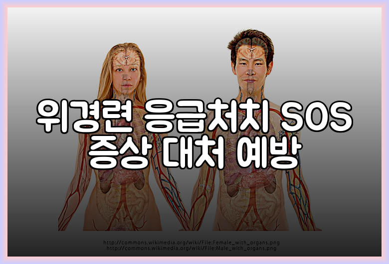 위경련 응급처치 SOS 증상 대처 예방