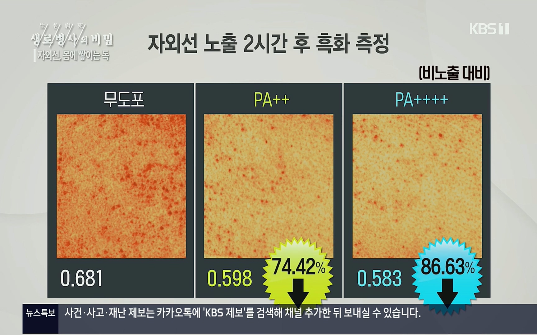 생로병사의 비밀.E824.220629p.H264-F1RST.mp4_20220630_205910.259.jpg