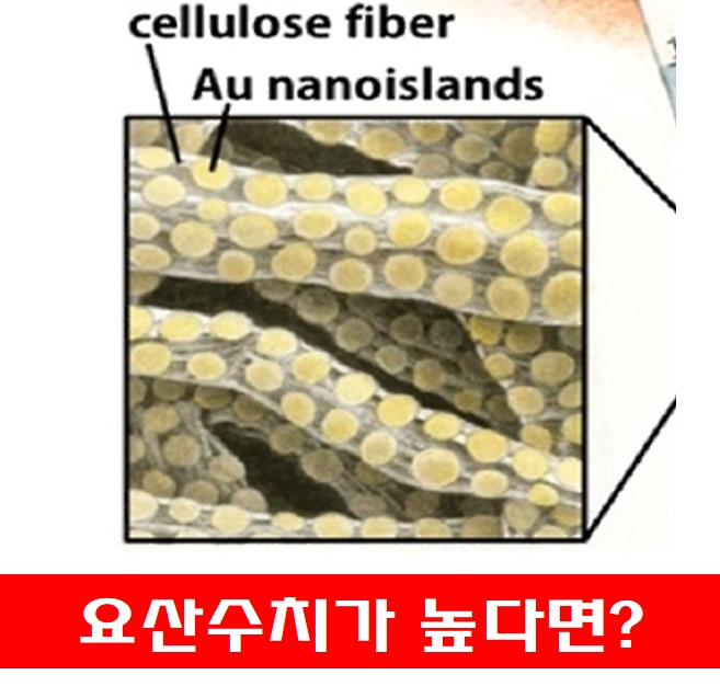  요산수치가 높다면? , 뭐가 문제일까?