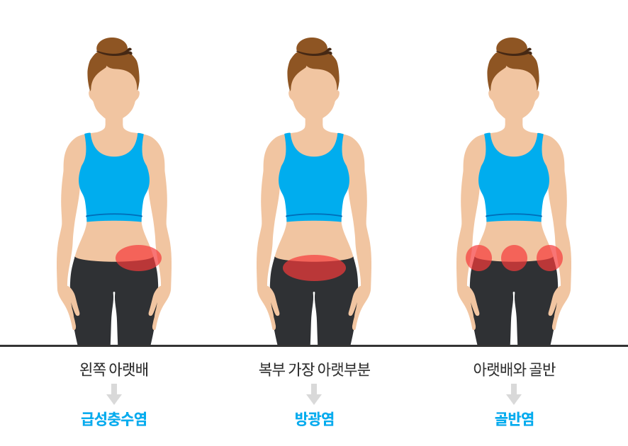 왼쪽 아랫배 사진