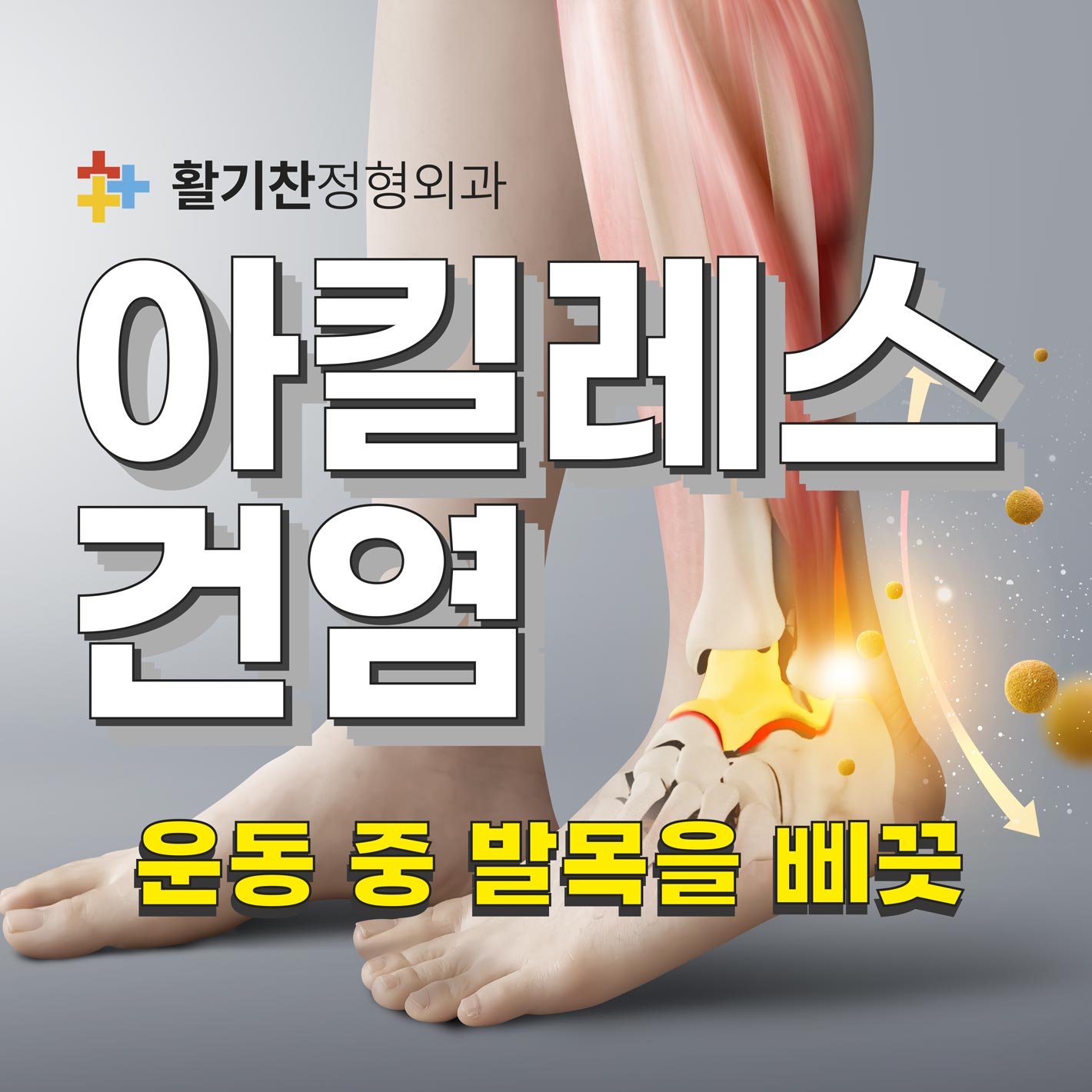  구산동통증의학과, 운동 중 발목을 삐끗하면 아킬레스건염?