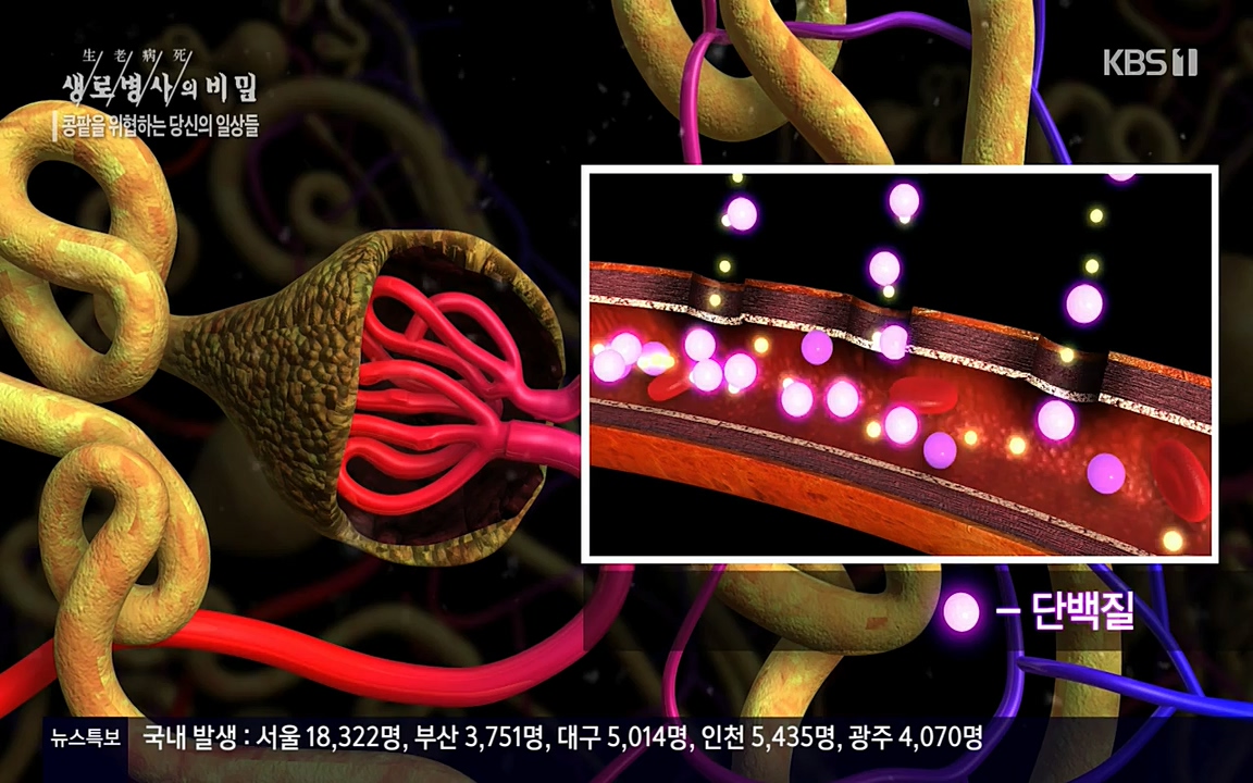 생로병사의 비밀.E819.220421p-NEXT.mp4_20220421_194723.556.jpg