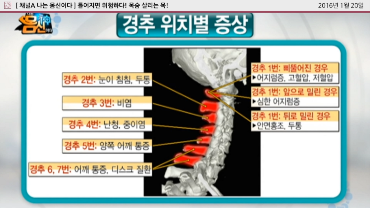 경추 위치별 증상