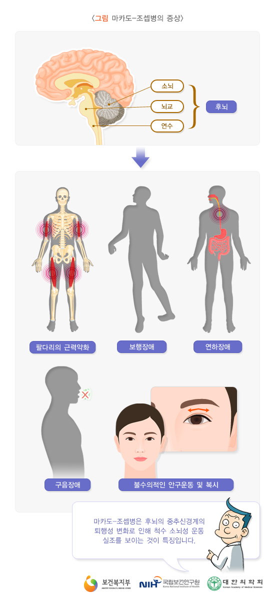 Symptoms of Machado-Joseph Disease