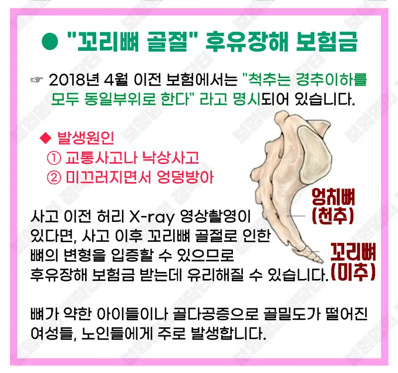  후유장해 발생 원인: 사고, 질병, 치료 과정까지 완벽 정리