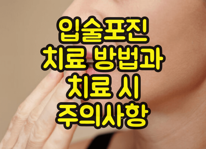 입술포진 치료방법