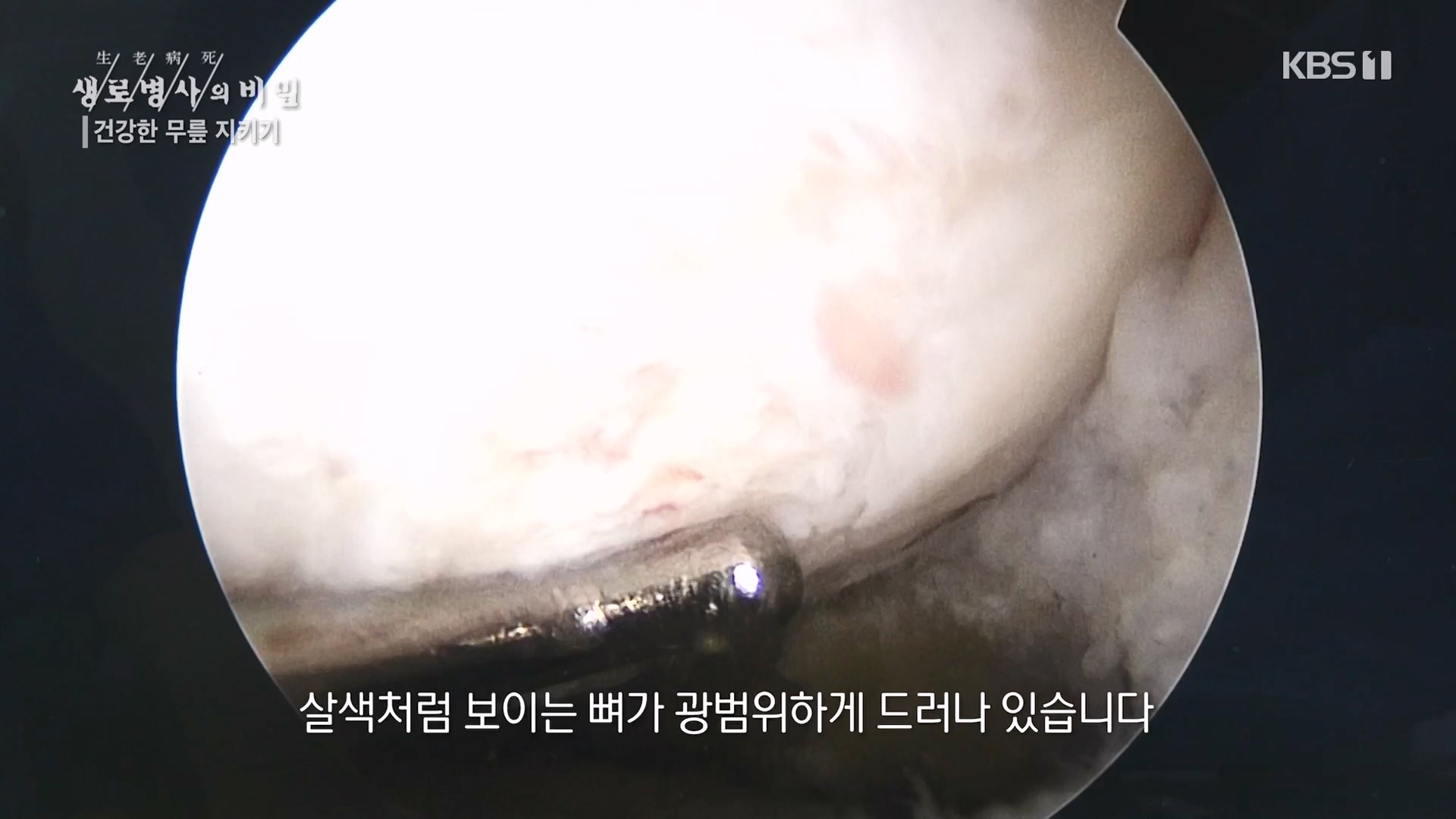 생로병사의 비밀.E873.230607p-NEXT.mp4_20230608_202211.032.jpg