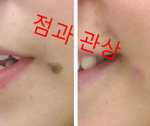  [점의 위치]  각 나라별 속담