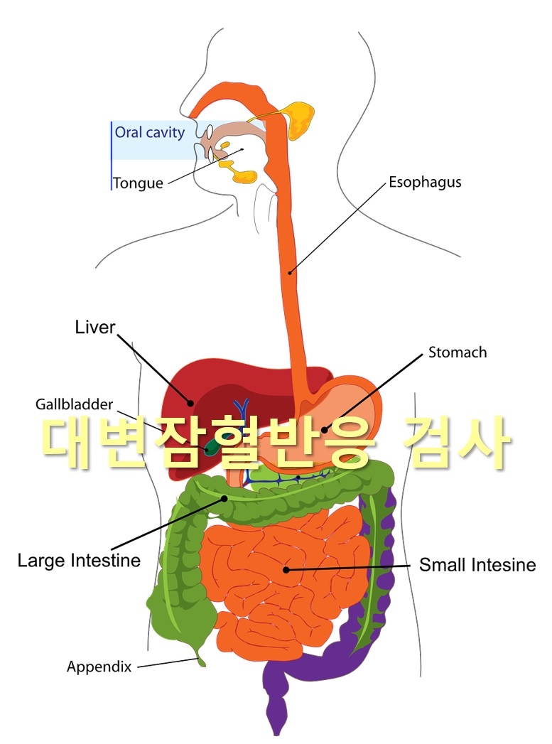  대장암 조기진단을 위한 대변잠혈반응 검사