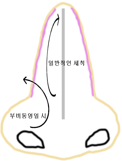  코 세척은 어떻게 하는건가요?