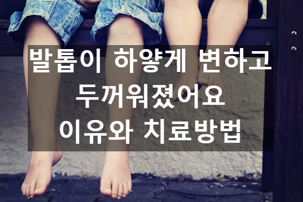  발톱이 하얗게 변하고 두꺼워졌어요 이유와 치료방법