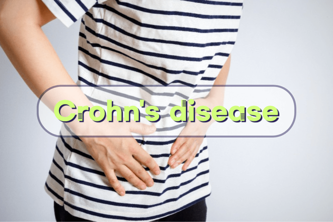 Crohn&#39;s disease