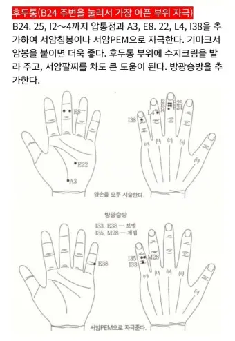 두통 수지침 편두통 혈자리_1