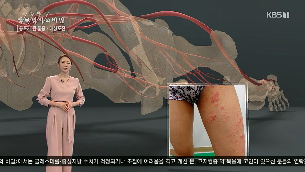 생로병사의 비밀.E857.230223p.H264-F1RST.mp4_20230223_202249.270.jpg