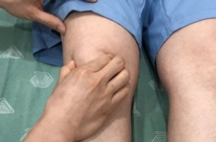  무릎 통증, 슬개대퇴증후군(슬개골연골연화증) 스트레칭 및 운동 알아봤습니다.